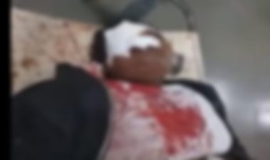 बियर बार में युवती के सिर में मारी बोतल, उपचार के दौरान मौत; परिजनों ने घेरा थाना