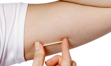 Condom का झंझट खत्म! अब न खानी पड़ेगी दवा, न सहना होगा दर्द, एक बार लगवा लीजिए यह 1 चीज फिर सालों तक रहें टेंशन फ्री