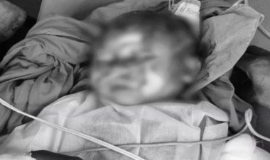 रायगढ़ कार्बन प्लांट हादसा: आग में झुलसी 9 महीने की मासूम की मौत, कई मजदूरों की हालत गंभीर